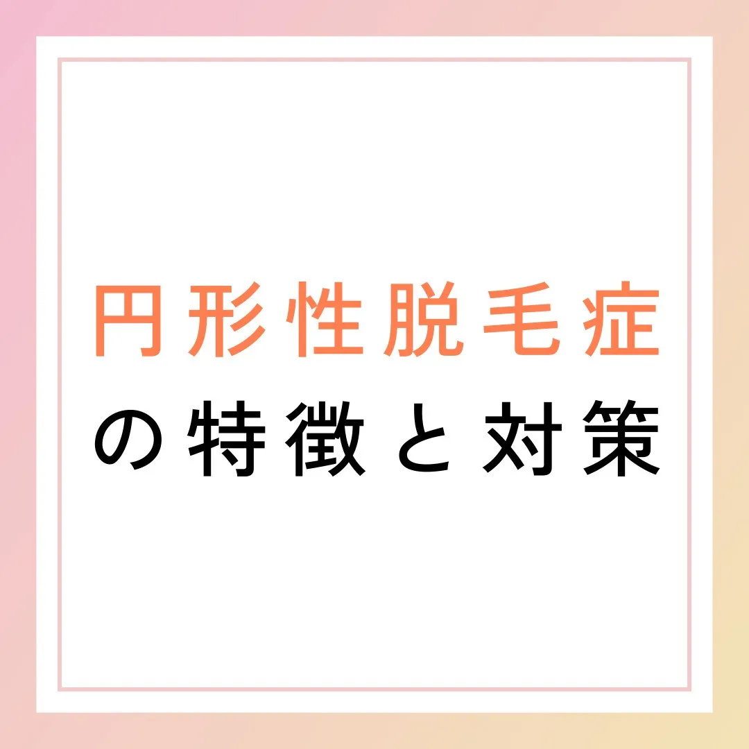 円形性脱毛症の特徴と対策🎯