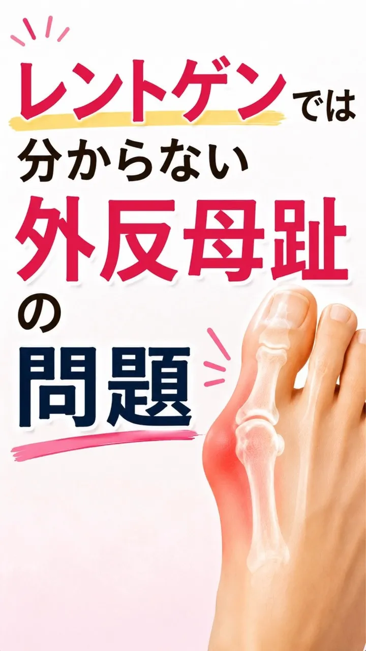 外反母趾の診断で、