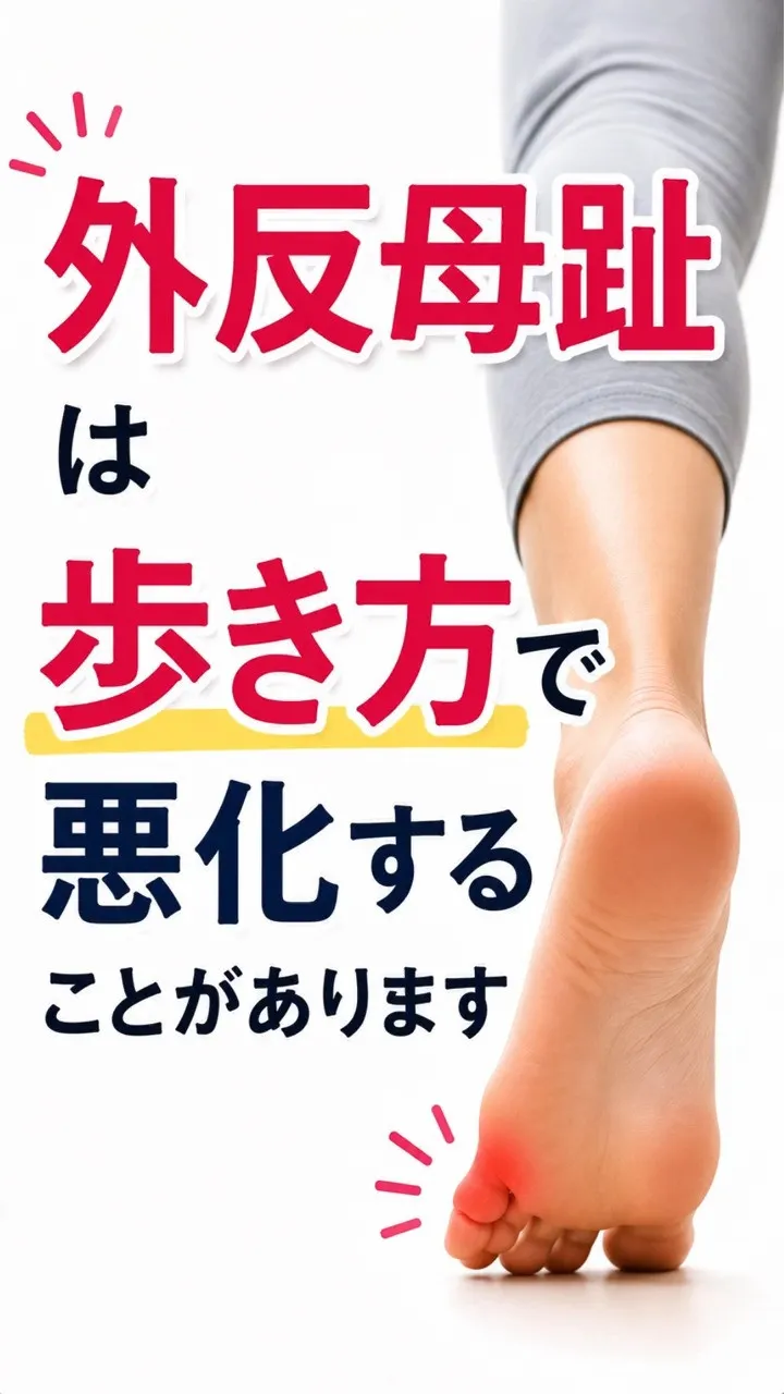 外反母趾は、
